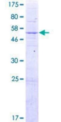 Novus Biologicals Recombinant Human RG9MTD1 GST (N-Term) Protein 2 &mu;g | Buy Online | Novus Biologicals&trade; | Fisher Scientific