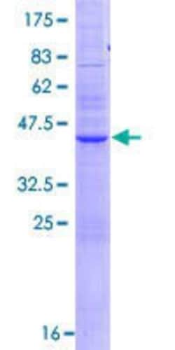 Novus Biologicals Recombinant Human RHBDL2 GST (N-Term) Protein 10 &mu;g | Buy Online | Novus Biologicals&trade; | Fisher Scientific