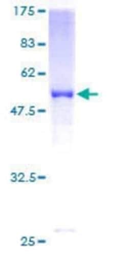 Novus Biologicals Recombinant Human SOHLH2 GST (N-Term) Protein 10 &mu;g | Buy Online | Novus Biologicals&trade; | Fisher Scientific