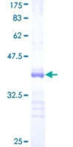 Novus Biologicals Recombinant Human RNF125 GST (N-Term) Protein 10 &mu;g | Buy Online | Novus Biologicals&trade; | Fisher Scientific