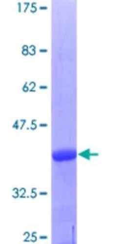 Novus Biologicals Recombinant Human UCKL1 GST (N-Term) Protein 25 &mu;g | Buy Online | Novus Biologicals&trade; | Fisher Scientific