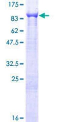 Novus Biologicals Recombinant Human TTC12 GST (N-Term) Protein 10 &mu;g | Buy Online | Novus Biologicals&trade; | Fisher Scientific