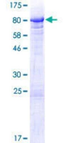 Novus Biologicals&trade;&nbsp;Recombinant Human BANP GST (N-Term) Protein