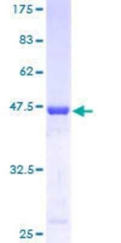 Novus Biologicals Recombinant Human C20orf27 GST (N-Term) Protein 25 &mu;g | Buy Online | Novus Biologicals&trade; | Fisher Scientific