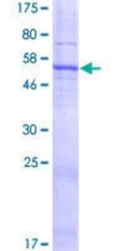 Novus Biologicals Recombinant Human SLC25A38 GST (N-Term) Protein 25 &mu;g | Buy Online | Novus Biologicals&trade; | Fisher Scientific