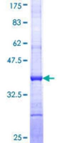 Novus Biologicals Recombinant Human ULK4 GST (N-Term) Protein 10 &mu;g | Buy Online | Novus Biologicals&trade; | Fisher Scientific