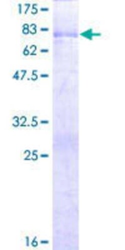 Novus Biologicals Recombinant Human PAK1 interacting protein 1 GST (N-Term) Protein 2 &mu;g | Buy Online | Novus Biologicals&trade; | Fisher Scientific
