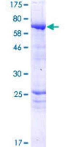 Novus Biologicals Recombinant Human G5pr GST (N-Term) Protein 25 &mu;g | Buy Online | Novus Biologicals&trade; | Fisher Scientific