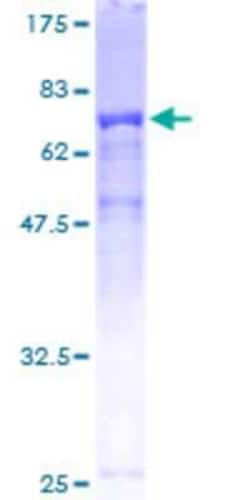 Novus Biologicals&trade;&nbsp;Recombinant Human TTC38 GST (N-Term) Protein