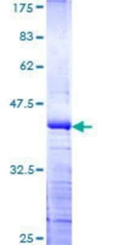 Novus Biologicals Recombinant Human PHIP GST (N-Term) Protein 10 &mu;g | Buy Online | Novus Biologicals&trade; | Fisher Scientific