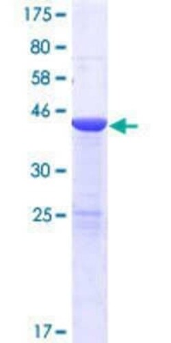 Novus Biologicals Recombinant Human USP47 GST (N-Term) Protein 10 &mu;g | Buy Online | Novus Biologicals&trade; | Fisher Scientific
