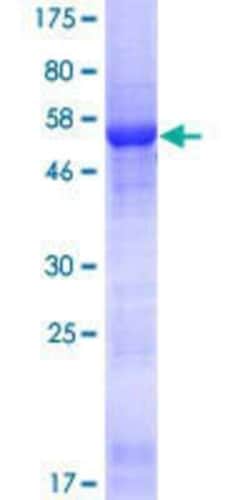Novus Biologicals Recombinant Human CDCA4 GST (N-Term) Protein 25 &mu;g | Buy Online | Novus Biologicals&trade; | Fisher Scientific