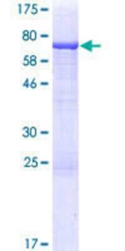 Novus Biologicals Recombinant Human TRMT12 GST (N-Term) Protein 10 &mu;g | Buy Online | Novus Biologicals&trade; | Fisher Scientific