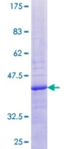 Novus Biologicals Recombinant Human MRPL20 GST (N-Term) Protein 25 &mu;g | Buy Online | Novus Biologicals&trade; | Fisher Scientific