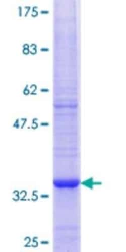 Novus Biologicals Recombinant Human ATG16L1 GST (N-Term) Protein 25 &mu;g | Buy Online | Novus Biologicals&trade; | Fisher Scientific