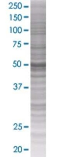 Novus Biologicals ZWILCH 293T Cell Transient Overexpression Lysate 0.1 mL | Buy Online | Novus Biologicals&trade; | Fisher Scientific