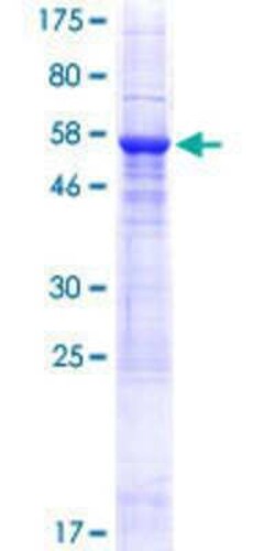 Novus Biologicals Recombinant Human SUSD4 GST (N-Term) Protein 25 &mu;g | Buy Online | Novus Biologicals&trade; | Fisher Scientific