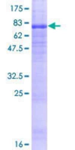 Novus Biologicals Recombinant Human WIPI1 GST (N-Term) Protein 10 &mu;g | Buy Online | Novus Biologicals&trade; | Fisher Scientific