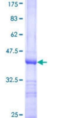 Novus Biologicals Recombinant Human DET1 GST (N-Term) Protein 25 &mu;g | Buy Online | Novus Biologicals&trade; | Fisher Scientific