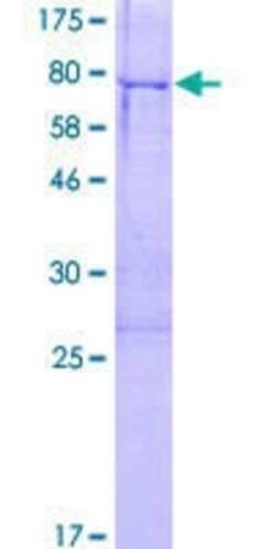 Novus Biologicals Recombinant Human ZNF312 GST (N-Term) Protein 2 &mu;g | Buy Online | Novus Biologicals&trade; | Fisher Scientific