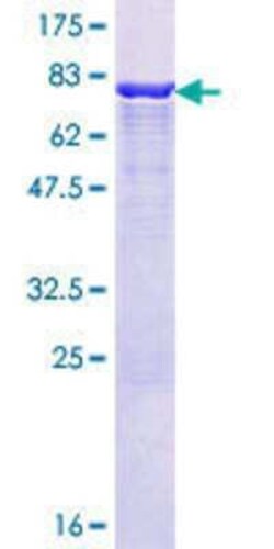 Novus Biologicals Recombinant Human HIPPI GST (N-Term) Protein 10 &mu;g | Buy Online | Novus Biologicals&trade; | Fisher Scientific