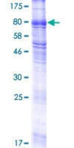 Novus Biologicals Recombinant Human SLC38A4 GST (N-Term) Protein 25 &mu;g | Buy Online | Novus Biologicals&trade; | Fisher Scientific