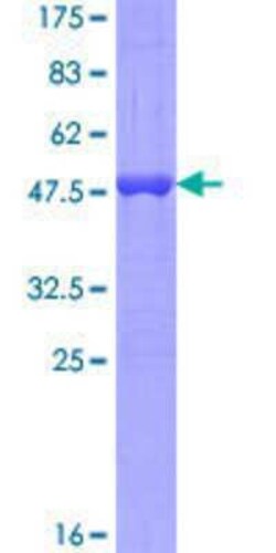 Novus Biologicals Recombinant Human MED9 GST (N-Term) Protein 25 &mu;g | Buy Online | Novus Biologicals&trade; | Fisher Scientific