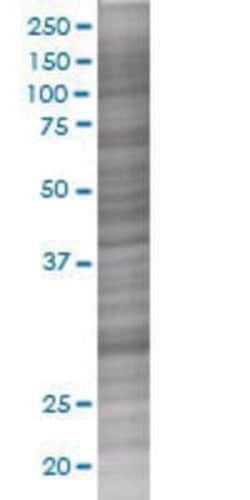 Novus Biologicals RALGPS2 293T Cell Transient Overexpression Lysate 0.1 mL | Buy Online | Novus Biologicals&trade; | Fisher Scientific