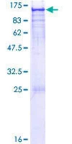 Novus Biologicals Recombinant Human ARHGAP17 GST (N-Term) Protein 10 &mu;g | Buy Online | Novus Biologicals&trade; | Fisher Scientific