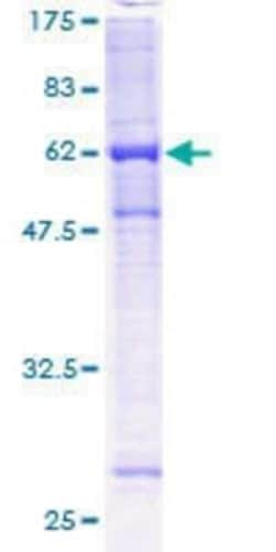 Novus Biologicals Recombinant Human FANCL GST (N-Term) Protein 10 &mu;g | Buy Online | Novus Biologicals&trade; | Fisher Scientific