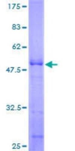 Novus Biologicals Recombinant Human Akirin2 GST (N-Term) Protein 25 &mu;g | Buy Online | Novus Biologicals&trade; | Fisher Scientific