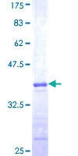 Novus Biologicals Recombinant Human TRIM68 GST (N-Term) Protein 10 &mu;g | Buy Online | Novus Biologicals&trade; | Fisher Scientific