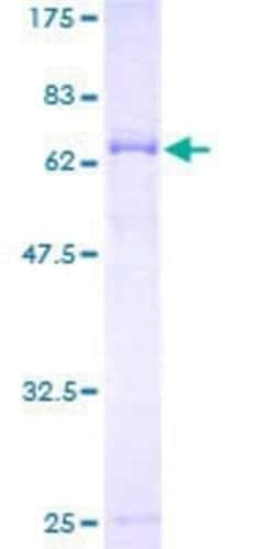 Novus Biologicals Recombinant Human TMEM16K GST (N-Term) Protein 10 &mu;g | Buy Online | Novus Biologicals&trade; | Fisher Scientific