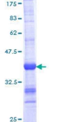 Novus Biologicals Recombinant Human ARMC4 GST (N-Term) Protein 10 &mu;g | Buy Online | Novus Biologicals&trade; | Fisher Scientific
