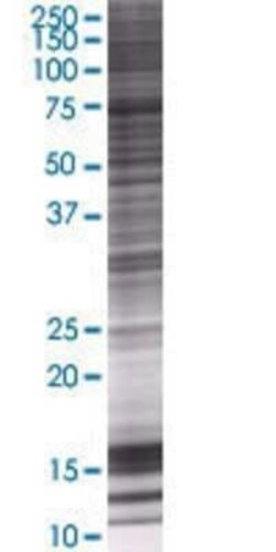 Novus Biologicals SRBD1 293T Cell Transient Overexpression Lysate 0.1 mL | Buy Online | Novus Biologicals&trade; | Fisher Scientific