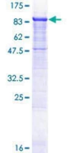 Novus Biologicals Recombinant Human WDR79 GST (N-Term) Protein 10 &mu;g | Buy Online | Novus Biologicals&trade; | Fisher Scientific
