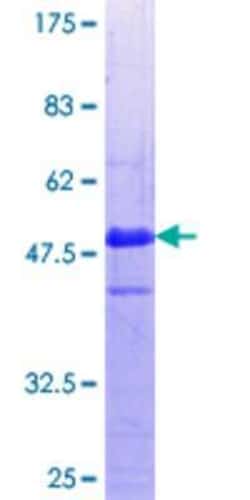 Novus Biologicals Recombinant Human WDR79 GST (N-Term) Protein 10 &mu;g | Buy Online | Novus Biologicals&trade; | Fisher Scientific