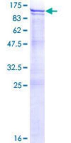 Novus Biologicals Recombinant Human ANKZF1 GST (N-Term) Protein 25 &mu;g | Buy Online | Novus Biologicals&trade; | Fisher Scientific