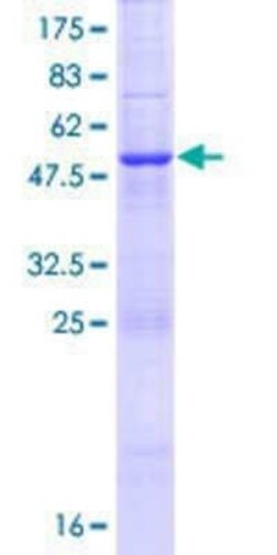 Novus Biologicals Recombinant Human CEP27 GST (N-Term) Protein 10 &mu;g | Buy Online | Novus Biologicals&trade; | Fisher Scientific