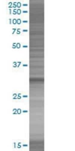 Novus Biologicals&trade;&nbsp;Borealin 293T Cell Transient Overexpression Lysate