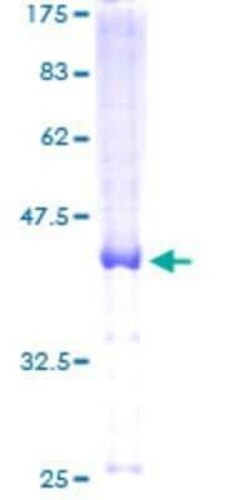 Novus Biologicals Recombinant Human LRRC8D GST (N-Term) Protein 10 &mu;g | Buy Online | Novus Biologicals&trade; | Fisher Scientific