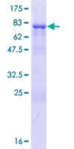 Novus Biologicals Recombinant Human RBM23 GST (N-Term) Protein 25 &mu;g | Buy Online | Novus Biologicals&trade; | Fisher Scientific