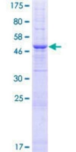 Novus Biologicals Recombinant Human TMEM38B GST (N-Term) Protein 10 &mu;g | Buy Online | Novus Biologicals&trade; | Fisher Scientific