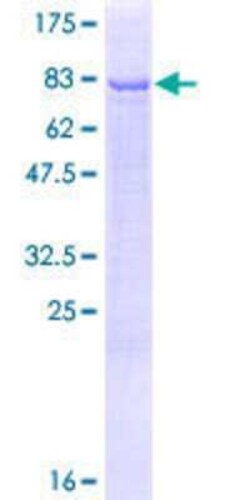Novus Biologicals Recombinant Human DALRD3 GST (N-Term) Protein 25 &mu;g | Buy Online | Novus Biologicals&trade; | Fisher Scientific
