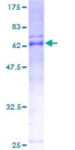 Novus Biologicals Recombinant Human ARMC1 GST (N-Term) Protein 10 &mu;g | Buy Online | Novus Biologicals&trade; | Fisher Scientific