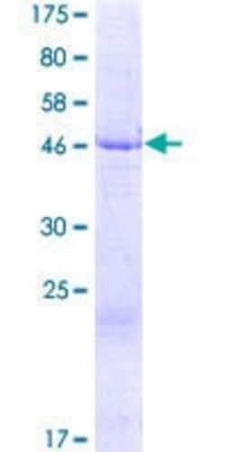 Novus Biologicals Recombinant Human TMEM33 GST (N-Term) Protein 2 &mu;g | Buy Online | Novus Biologicals&trade; | Fisher Scientific