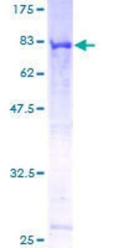 Novus Biologicals Recombinant Human CEP55 GST (N-Term) Protein 10 &mu;g | Buy Online | Novus Biologicals&trade; | Fisher Scientific