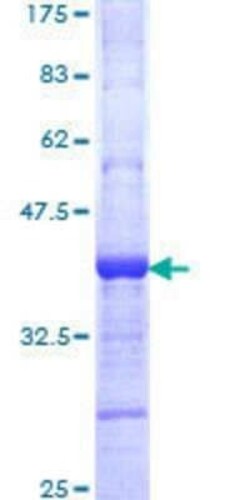 Novus Biologicals Recombinant Human MSL2L1 GST (N-Term) Protein 25 &mu;g | Buy Online | Novus Biologicals&trade; | Fisher Scientific
