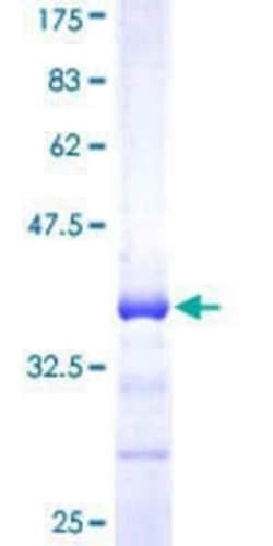Novus Biologicals Recombinant Human PRMT6 GST (N-Term) Protein 10 &mu;g | Buy Online | Novus Biologicals&trade; | Fisher Scientific