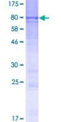 Novus Biologicals Recombinant Human TBCCD1 GST (N-Term) Protein 10 &mu;g | Buy Online | Novus Biologicals&trade; | Fisher Scientific
